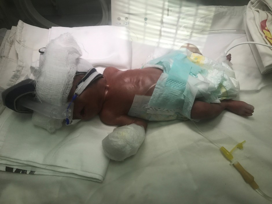 preemie 4.jpg